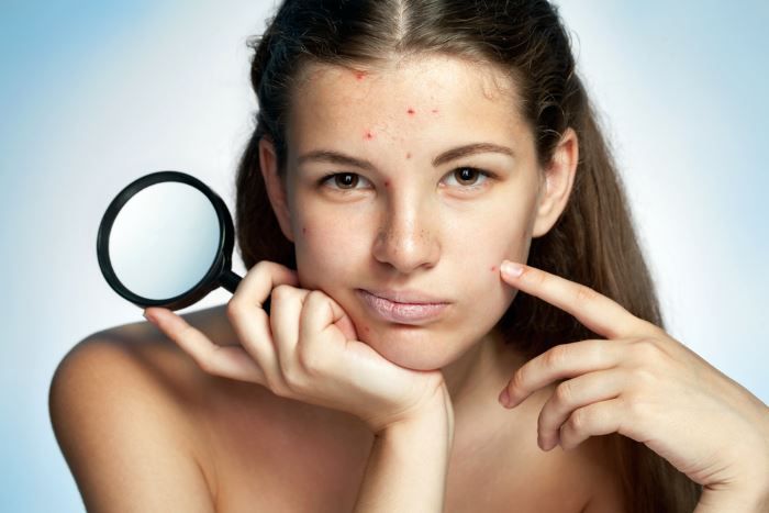 Hautpflege – Hautunreinheiten erfolgreich und ohne Chemie behandeln