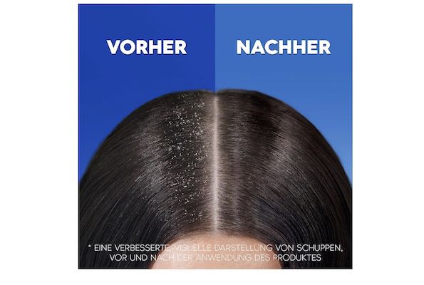 XXL Head & Shoulders 2 in 1 Shampoo und Spülung für 8€ (statt 12€)