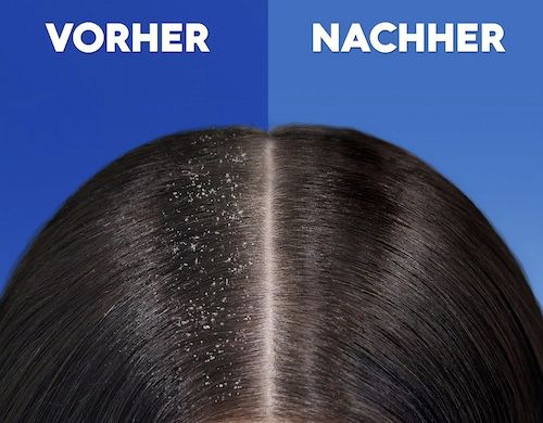 500 ml Head & Shoulders For Men Anti Schuppen Shampoo für 3,60€ (statt 7€)