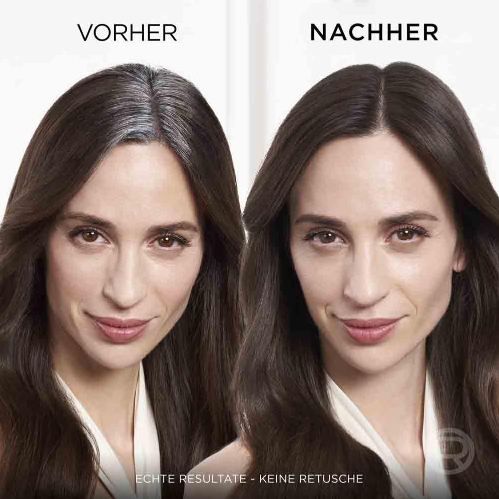 👩🏻‍🦳 Loreal Magic Retouch Ansatz Kaschierspray, Braun bis Mittelbraun ab 3,79€ (statt 7€)