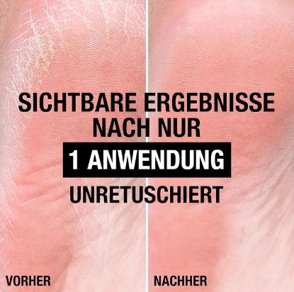🦶🏻 3x Neutrogena Norwegische Formel Intense Repair Fußpflege ab 9,57€ (statt 15€)