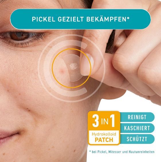🩹 15er Pack Compeed Anti-Pickel Diskret Patch ab 3,79€ (statt 8€) 🩹 15er Pack Compeed Anti Pickel Diskret Patch ab 3,79€ (statt 8€)