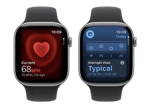 đ Apple Watch Series 11 (5G, 46mm) in Violett fĂŒr 404,95⏠(statt 499âŹ) đ Apple Watch Series 11 (5G, 46mm) in Violett fĂŒr 404,95⏠(statt 499âŹ)
